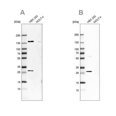 Western Blot: DCI Antibody [NBP1-91821] - Analysis using Anti-ECI1 antibody NBP1-91821 (A) shows similar pattern to independent antibody NBP1-91822 (B).