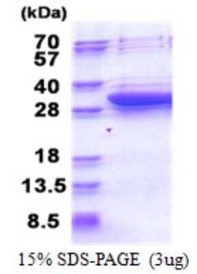 SDS-PAGE Recombinant Human DCI His Protein