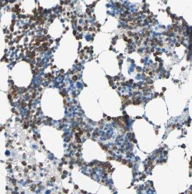 Immunohistochemistry-Paraffin: DCIR/CLEC4A Antibody [NBP1-84446] - Staining of human bone marrow shows membranous positivity in hematopoietic cells.