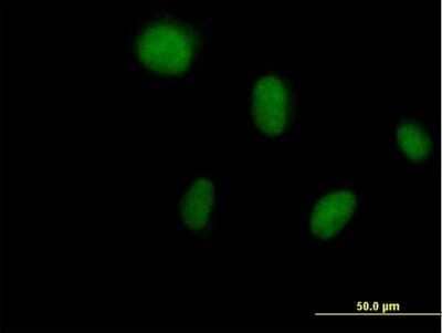 Immunocytochemistry/Immunofluorescence: DCK Antibody [H00001633-B01P] - Analysis of purified antibody to DCK on HeLa cell. (antibody concentration 10 ug/ml)
