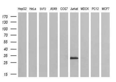 Western Blot: DCK Antibody (OTI3F5) - Azide and BSA Free [NBP2-70555] - Analysis of extracts (35ug) from 9 different cell lines by using anti-DCK monoclonal antibody (HepG2: human; HeLa: human; SVT2: mouse; A549: human; COS7: monkey; Jurkat: human; MDCK: canine; PC12: rat; MCF7: human) (1:200).