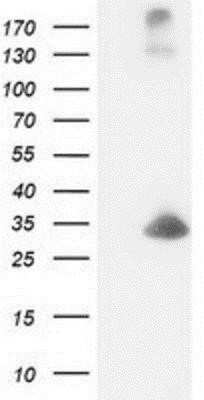 Western Blot: DCK Antibody (OTI3F5) - Azide and BSA Free [NBP2-70555] - HEK293T cells were transfected with the pCMV6-ENTRY control (Left lane) or pCMV6-ENTRY DCK (Right lane) cDNA for 48 hrs and lysed. Equivalent amounts of cell lysates (5 ug per lane) were separated by SDS-PAGE and immunoblotted with anti-DCK.