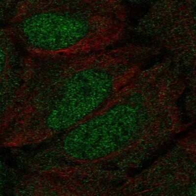 Immunocytochemistry/Immunofluorescence: DCLK1 Antibody [NBP2-58700] - Staining of human cell line U-2 OS shows localization to nucleus & cytosol.