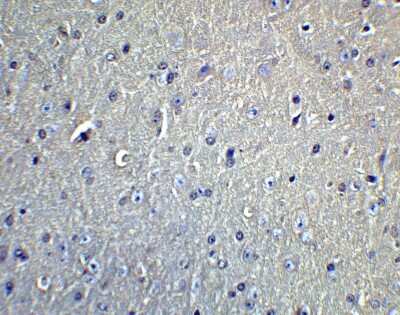 Immunohistochemistry: DCLK1 Antibody [NBP1-77127] - Staining of DCLK1 in mouse brain tissue with DCLK1 Antibodyat 5 ug/mL.