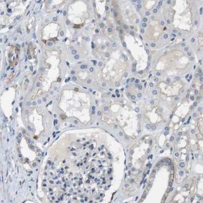 Immunohistochemistry-Paraffin: DCLK1 Antibody [NBP2-48530] - Staining of human kidney shows low expression as expected.