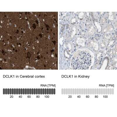 Immunohistochemistry-Paraffin: DCLK1 Antibody [NBP2-48530] - Staining in human cerebral cortex and kidney tissues using anti-DCLK1 antibody. Corresponding DCLK1 RNA-seq data are presented for the same tissues.