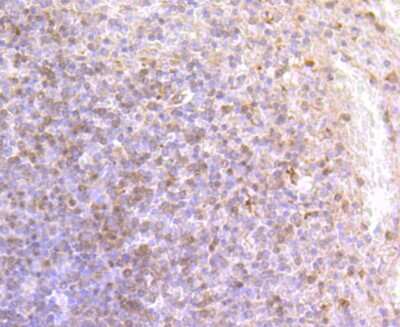 Immunohistochemistry-Paraffin: DCLK1 Antibody (JA11-03) [NBP2-67029] - Analysis of paraffin-embedded human spleen tissue using anti-DCAMKL1 antibody. Counter stained with hematoxylin.