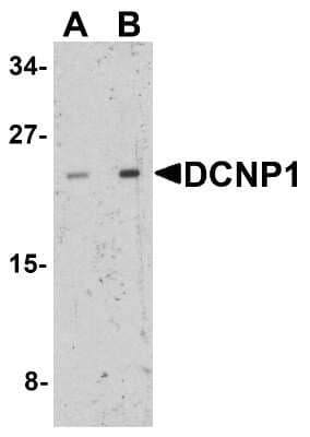 Western Blot DCNP1 Antibody - BSA Free
