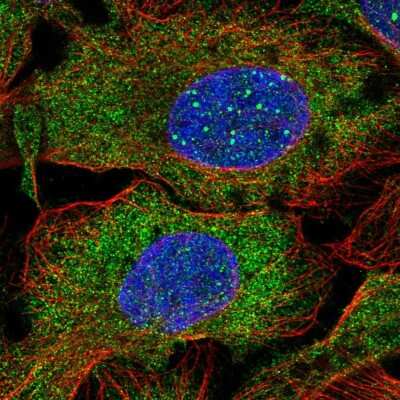 Immunocytochemistry/ Immunofluorescence DCP1B Antibody