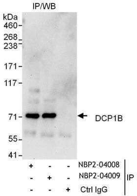 Immunoprecipitation: DCP1B Antibody [NBP2-04008] - Samples:  Whole cell lysate (1 mg for IP, 20% of IP loaded) from HeLa cells. Antibodies: Affinity purified rabbit anti-DCP1B antibody NBP2-04008 used for IP at 6 ug/mg lysate.  DCP1B was also immunoprecipitated by rabbit anti-DCP1B antibody NBP2-04009, which recognizes a downstream epitope.  For blotting immunoprecipitated DCP1B, NBP2-04008 was used at 0.4 ug/ml.  Detection: Chemiluminescence with an exposure time of 30 seconds.