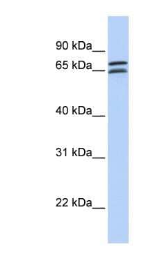 Western Blot: DCP1B Antibody [NBP1-79422] - 721_B cell lysate, concentration 0.2-1 ug/ml.