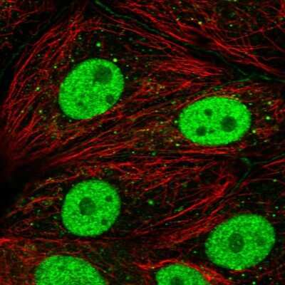 Immunocytochemistry/Immunofluorescence: DCP2 Antibody [NBP2-56996] - Staining of human cell line MCF7 shows localization to nucleoplasm, cell junctions & cytoplasmic bodies. Antibody staining is shown in green.