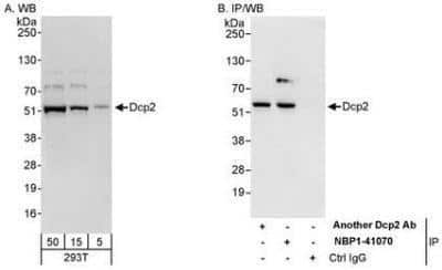 Western Blot: DCP2 Antibody [NBP1-41070] - Whole cell lysate (5, 15 and 50 mcg for WB; 1 mg for IP, 20% of IP loaded) from 293T cells. Affinity purified rabbit anti-Dcp2 used for WB at 0.1 mcg/ml (A) and 1 mcg/ml (B) and used for IP at 10 mcg/mg lysate.  Dcp2 was also immunoprecipitated by another rabbit anti-Dcp2 antibody, which recognizes an upstream epitope.