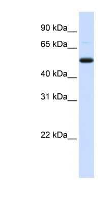 Western Blot: DCP2 Antibody [NBP1-57441] - Human Placenta lysate, concentration 0.2-1 ug/ml.