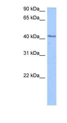 Western Blot: DCP2 Antibody [NBP1-57442] - Titration: 0.2-1 ug/ml Positive Control: Jurkat cell lysate.