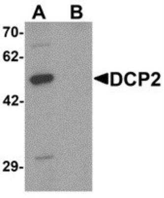 Western Blot: DCP2 Antibody [NBP2-81810] - Western blot analysis of DCP2 in 293 cell lysate with DCP2 antibody at 1 ug/mL in (A) the absence and (B) the presence of blocking peptide.