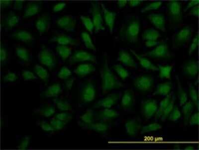 Immunocytochemistry/Immunofluorescence: DCPS Antibody (1G4) [H00028960-M02] - Analysis of monoclonal antibody to DCPS on HeLa cell. Antibody concentration 10 ug/ml.