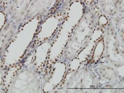 Immunohistochemistry-Paraffin: DCPS Antibody (1G4) [H00028960-M02] - Analysis of monoclonal antibody to DCPS on formalin-fixed paraffin-embedded human kidney. Antibody concentration 1.5 ug/ml.