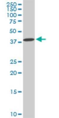 Western Blot: DCPS Antibody (1G4) [H00028960-M02] - DCPS monoclonal antibody (M02), clone 1G4. Analysis of DCPS expression in PC-12.