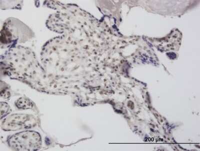 Immunohistochemistry-Paraffin: DCPS Antibody (3E5) [H00028960-M03] - Analysis of monoclonal antibody to DCPS on formalin-fixed paraffin-embedded human placenta. Antibody concentration 3 ug/ml