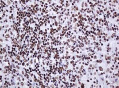 Immunohistochemistry: DCPS Antibody (4H8) [NBP2-45650] - Analysis of Human lymphoma tissue. (Heat-induced epitope retrieval by 10mM citric buffer, pH6.0, 120C for 3min)