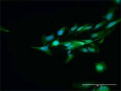 Immunocytochemistry/Immunofluorescence: DCPS Antibody [H00028960-D01P] - Analysis of antibody to DCPS on HeLa cell. Antibody concentration 30 ug/ml.