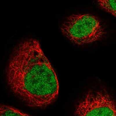 <b>Genetic Strategies Validation. </b>Immunocytochemistry/Immunofluorescence: DCPS Antibody [NBP1-81749] - Immunofluorescent staining of human cell line A-431 shows localization to nucleoplasm.