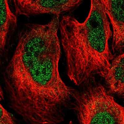 Immunocytochemistry/Immunofluorescence: DCPS Antibody [NBP2-56249] - Staining of human cell line U-2 OS shows localization to nucleoplasm & cytosol.