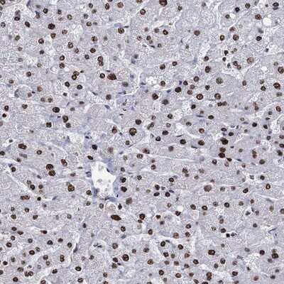 Immunohistochemistry-Paraffin: DCPS Antibody [NBP1-81749] - Staining of human liver shows strong nuclear positivity in hepatocytes.