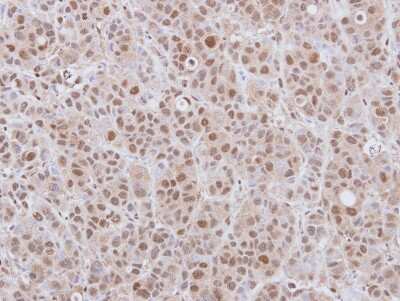 Immunohistochemistry-Paraffin: DCPS Antibody [NBP2-16111] - Immunohistochemical analysis of paraffin-embedded MCF7 xenograft, using antibody at 1:100 dilution.