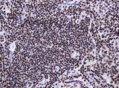 Immunohistochemistry: DCPS Antibody (OTI4H8) - Azide and BSA Free [NBP2-71839] - Analysis of Human lymph node tissue. (Heat-induced epitope retrieval by 10mM citric buffer, pH6.0, 120C for 3min)