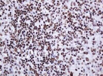 Immunohistochemistry: DCPS Antibody (OTI4H8) - Azide and BSA Free [NBP2-71839] - Analysis of Human lymphoma tissue. (Heat-induced epitope retrieval by 10mM citric buffer, pH6.0, 120C for 3min)