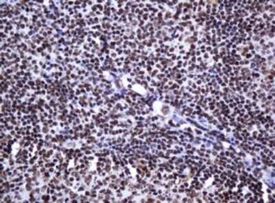 Immunohistochemistry: DCPS Antibody (OTI4H8) - Azide and BSA Free [NBP2-71839] - Analysis of Human tonsil tissue. (Heat-induced epitope retrieval by 10mM citric buffer, pH6.0, 120C for 3min)