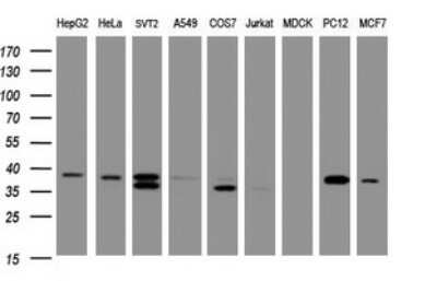 Western Blot: DCPS Antibody (OTI4H8) - Azide and BSA Free [NBP2-71839] - Analysis of extracts (35ug) from 9 different cell lines by using DCPS monoclonal antibody (HepG2: human; HeLa: human; SVT2: mouse; A549: human; COS7: monkey; Jurkat: human; MDCK: canine; PC12: rat; MCF7: human).