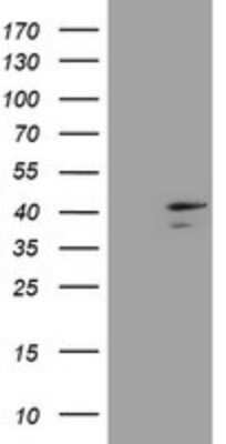 Western Blot DCPS Antibody (OTI4H8) - Azide and BSA Free