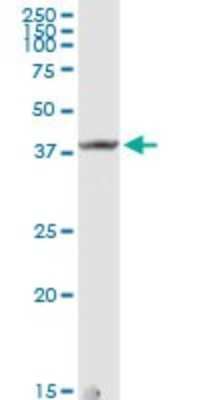 Western Blot: DCPS Antibody [H00028960-D01P] - Analysis of DCPS expression in mouse liver.