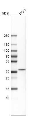 Western Blot: DCPS Antibody [NBP1-81749] - Analysis in human cell line PC-3.