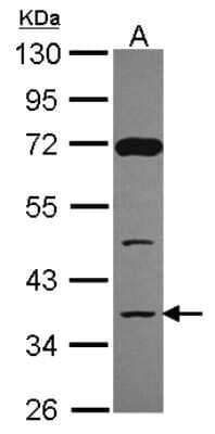 Western Blot: DCPS Antibody [NBP2-16111] - Sample (30 ug of whole cell lysate) A: A549 10% SDS PAGE gel, diluted at 1:500.