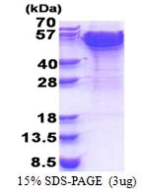 SDS-PAGE Recombinant Human Dynactin Subunit 2/DCTN2/DCTN-50 His Protein