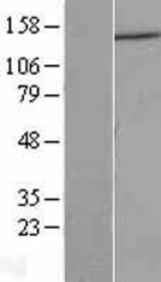 Western Blot: DCTN1 Overexpression Lysate (Adult Normal) [NBL1-09749] Left-Empty vector transfected control cell lysate (HEK293 cell lysate); Right -Over-expression Lysate for DCTN1.