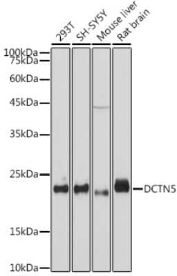 Western Blot: DCTN5 Antibody (9W2S4) [NBP3-15714] - Western blot analysis of extracts of various cell lines, using DCTN5 antibody (NBP3-15714) at 1:1000 dilution. Secondary antibody: HRP Goat Anti-Rabbit IgG (H+L) at 1:10000 dilution. Lysates/proteins: 25ug per lane. Blocking buffer: 3% nonfat dry milk in TBST. Detection: ECL Basic Kit. Exposure time: 10s.