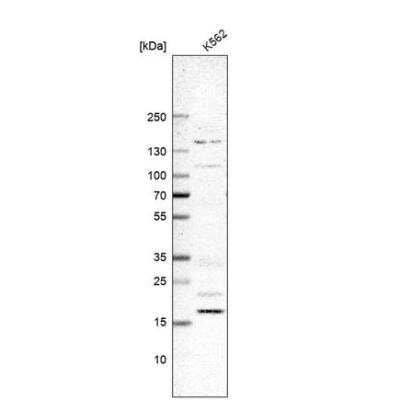 Western Blot: DCTN5 Antibody [NBP1-81122] - Analysis in human cell line K562.