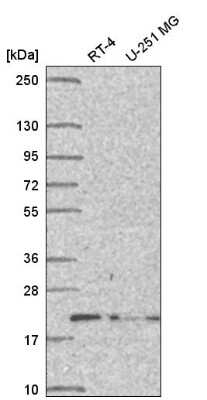 Western Blot: DCTN5 Antibody [NBP2-57058] - Western blot analysis in human cell line RT-4 and human cell line U-251 MG.