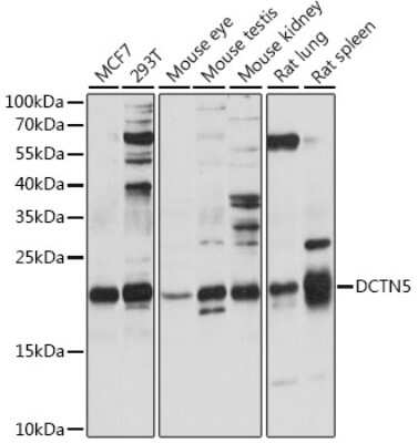Western Blot: DCTN5 Antibody [NBP2-92279] - Analysis of extracts of various cell lines, using DCTN5 at 1:1000 dilution.Secondary antibody: HRP Goat Anti-Rabbit IgG (H+L) at 1:10000 dilution.Lysates/proteins: 25ug per lane.Blocking buffer: 3% nonfat dry milk in TBST.Detection: ECL Basic Kit .Exposure time: 60s.