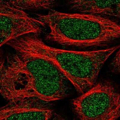Immunocytochemistry/Immunofluorescence: DCUN1D1 Antibody [NBP1-85275] - Immunofluorescent staining of human cell line U-2 OS shows localization to nucleoplasm & cytosol.