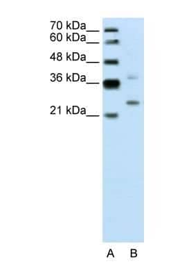 Western Blot: DCUN1D1 Antibody [NBP1-56537] - Jurkat cell lysate, Antibody Titration: 0.2-1 ug/ml