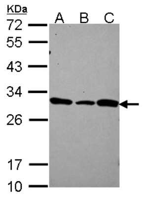 Western Blot: DCUN1D1 Antibody [NBP2-16116] - Sample (30 ug of whole cell lysate) A: A431 B: JurKat C: Raji 12% SDS PAGE gel, diluted at 1:1000.