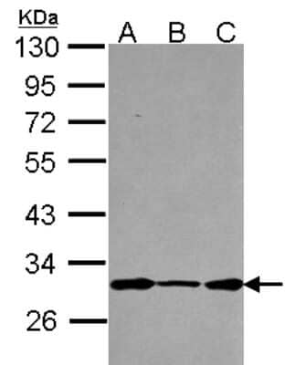 Western Blot: DCUN1D1 Antibody [NBP2-16117] - Sample (30 ug of whole cell lysate) A: A431 B: JurKat C: Raji 12% SDS PAGE gel, diluted at 1:1000.