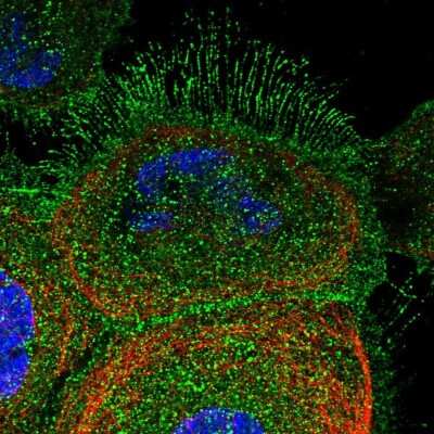 Immunocytochemistry/Immunofluorescence: DCUN1D2 Antibody [NBP1-88397] - Immunofluorescent staining of human cell line A-431 shows localization to plasma membrane & cytosol.