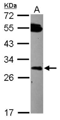 Western Blot: DCUN1D2 Antibody [NBP2-16118] - Sample (30 ug of whole cell lysate) A: HCT116 12% SDS PAGE gel, diluted at 1:1000.